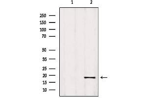 Western blot analysis of extracts from 293, using C9orf23 Antibody.
