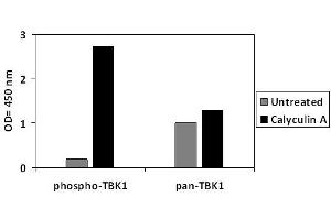 HeLa cells were treated or untreated with Calyculin A. (TBK1 Kit ELISA)