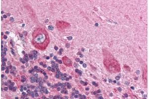 Human Brain, Cerebellum (formalin-fixed, paraffin-embedded) stained with HIF1AN antibody ABIN214112 at 5 ug/ml followed by biotinylated goat anti-rabbit IgG secondary antibody ABIN481713, alkaline phosphatase-streptavidin and chromogen.