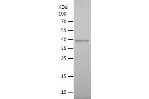 Western Blotting (WB) image for Myocyte Enhancer Factor 2D (MEF2D) (AA 363-521) protein (His-IF2DI Tag) (ABIN7124047)