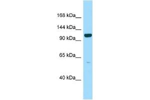 WB Suggested Anti-PPFIBP2 Antibody Titration: 1. (PPFIBP2 anticorps  (C-Term))