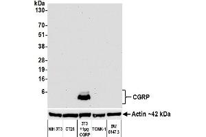 Western Blotting (WB) image for anti-Calcitonin-Related Polypeptide alpha (CALCA) antibody (ABIN7449372) (Recombinant CGRP anticorps)