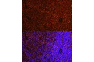 Immunofluorescence analysis of rat spleen cells using ASC/TMS1 Rabbit pAb (ABIN3021616, ABIN3021617, ABIN3021618, ABIN1513454 and ABIN6215392) at dilution of 1:250 (40x lens). (PYCARD anticorps  (AA 50-195))