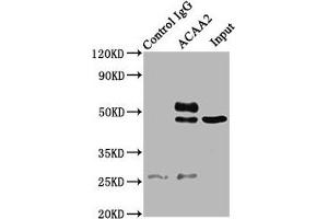 Immunoprecipitating ACAA2 in A549 whole cell lysate Lane 1: Rabbit control IgG (1 μg) instead of ABIN7142316 in A549 whole cell lysate.