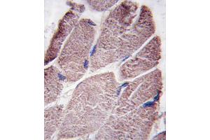 Formalin-fixed and paraffin-embedded human skeletal muscle tissue reacted with PTPD1 antibody , which was peroxidase-conjugated to the secondary antibody, followed by DAB staining.