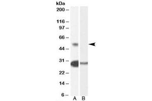 Western blot testing of human testis lysate with TCFL5 antibody at 0. (TCFL5 anticorps)
