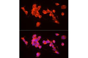 Immunofluorescence analysis of SH-SY5Y cells using GDNF Rabbit pAb (ABIN7267388) at dilution of 1:100 (40x lens). (GDNF anticorps  (AA 109-211))