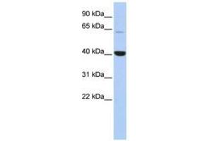 Image no. 1 for anti-Methyl-CpG Binding Domain Protein 1 (MBD1) (C-Term) antibody (ABIN6742952)