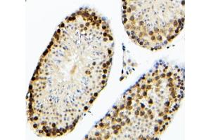 IHC analysis of SOX15 using anti-SOX15 antibody (ABIN6719624). (SOX15 anticorps  (AA 1-233))