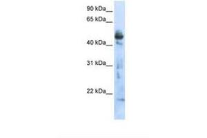Image no. 1 for anti-3-Oxoacyl-ACP Synthase, Mitochondrial (OXSM) (AA 290-339) antibody (ABIN6738235)