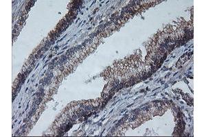 Image no. 3 for anti-Archain 1 (ARCN1) antibody (ABIN1497571)