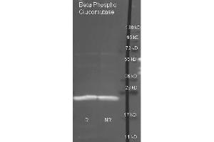 Goat anti antibody  was used to detect purified Beta Phospho Glucomutase under reducing (R) and non-reducing (NR) conditions. (Beta-Phosphoglucomutase anticorps)