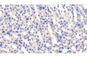 anti-Insulin-Like Growth Factor 1 (IGF1) (AA 33-102) antibody