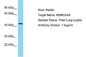 Host: Rabbit Target Name: NSMCE4A Sample Type: Fetal Lung lysates Antibody Dilution: 1. (NSMCE4A anticorps  (C-Term))