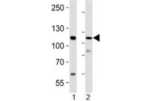 Western blot analysis of lysate from 1) human LNCaP cell line and 2) mouse lung tissue using PRDM16 antibody at 1:1000. (PRDM16 anticorps)