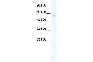 WB Suggested Anti-ZNF613 Antibody Titration:  0. (ZNF613 anticorps  (C-Term))