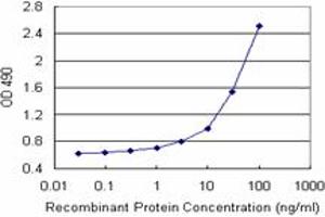 CSTB (Human) Matched Antibody Pair