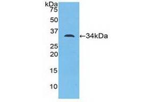 Detection of Recombinant MYO1D, Mouse using Polyclonal Antibody to Myosin ID (MYO1D) (Myosin ID anticorps  (AA 581-847))