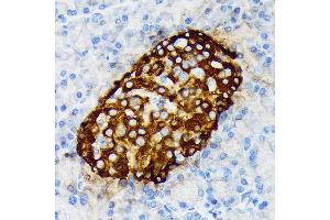 Immunohistochemistry of paraffin-embedded rat pancreatic islet using Chromogranin A Rabbit mAb (ABIN7266366) at dilution of 1:100 (40x lens). (Chromogranin A anticorps)