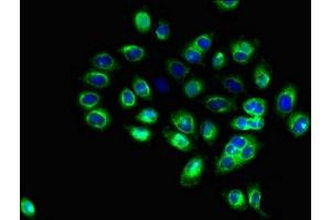 Immunofluorescent analysis of A549 cells using ABIN7171373 at dilution of 1:100 and Alexa Fluor 488-congugated AffiniPure Goat Anti-Rabbit IgG(H+L)