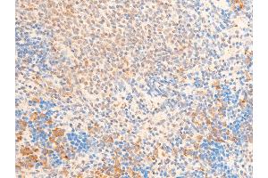 ABIN6267237 at 1/100 staining rat spleen tissue sections by IHC-P.