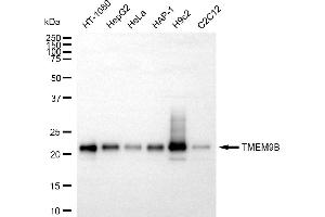 Western blotting analysis using TMEM9B antibody (ABIN7800560). (Recombinant TMEM9B anticorps)
