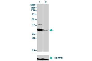 Western blot analysis of ZNF215 over-expressed 293 cell line, cotransfected with ZNF215 Validated Chimera RNAi (Lane 2) or non-transfected control (Lane 1). (ZNF215 anticorps  (AA 1-304))