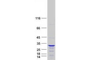 Validation with Western Blot (CCDC28B Protein (Myc-DYKDDDDK Tag))