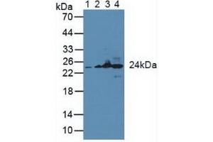 Figure. (GSTK1 anticorps  (AA 19-222))
