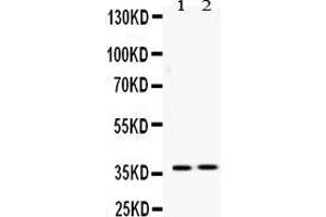 Western blot analysis of HDGF expression in rat liver extract ( Lane 1) and 22RV1 whole cell lysates ( Lane 2). (HDGF anticorps  (C-Term))