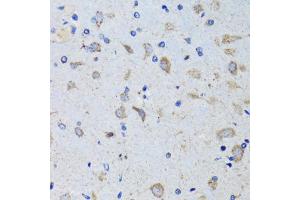 Immunohistochemistry of paraffin-embedded mouse brain using PTPN1 antibody. (PTPN1 anticorps)