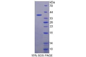 SDS-PAGE analysis of Human ANKRD1 Protein. (ANKRD1 Protéine)