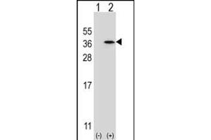 Western blot analysis of SPDYA (arrow) using rabbit polyclonal SPDYA Antibody (Center) (ABIN6244012 and ABIN6579062).