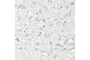Immunohistochemistry of paraffin-embedded rat brain using IL33 antibody at dilution of 1:100 (x40 lens). (IL-33 anticorps)