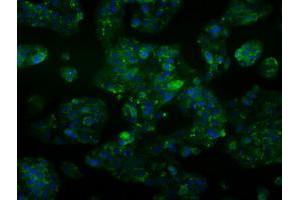 Image no. 3 for anti-Aldehyde Dehydrogenase 2 Family (Mitochondrial) (ALDH2) antibody (ABIN1496589) (ALDH2 anticorps)