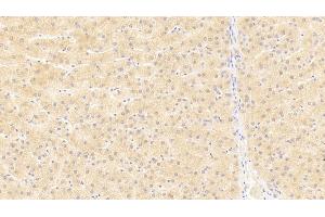 Detection of Flt3L in Human Liver Tissue using Monoclonal Antibody to FMS Like Tyrosine Kinase 3 Ligand (Flt3L)