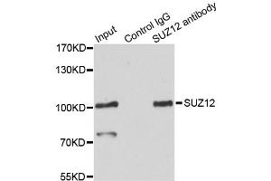 Immunoprecipitation analysis of 200ug extracts of HeLa cells using 3ug SUZ12 antibody. (SUZ12 anticorps)