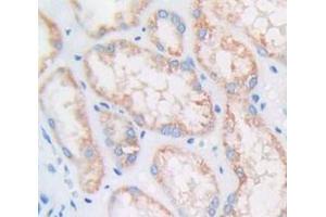 IHC-P analysis of Human Tissue, with DAB staining. (Cyclin D1 anticorps  (AA 1-295))