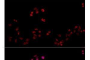 Immunofluorescence analysis of HeLa cells using PCNA Polyclonal Antibody at dilution of 1:100. (PCNA anticorps)