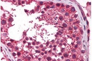 Human Testis: Formalin-Fixed, Paraffin-Embedded (FFPE)