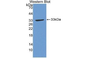 Western Blotting (WB) image for anti-Growth Associated Protein 43 (GAP43) (AA 1-274) antibody (ABIN1868109) (GAP43 anticorps  (AA 1-274))
