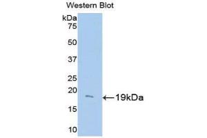 Western Blotting (WB) image for anti-Uncoupling Protein 2 (Mitochondrial, Proton Carrier) (UCP2) (AA 150-304) antibody (ABIN3205057) (UCP2 anticorps  (AA 150-304))