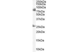 Image no. 1 for anti-Chromodomain Protein, Y-Like (CDYL) (C-Term) antibody (ABIN374294) (CDYL anticorps  (C-Term))