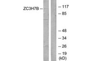 Western blot analysis of extracts from 293 cells, using ZC3H7B Antibody.