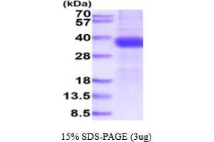 SDS-PAGE (SDS) image for Kallikrein-Related Peptidase 15 (KLK15) (AA 17-256) protein (His tag) (ABIN6388017)