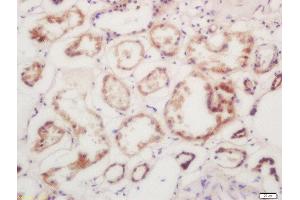 Formalin-fixed and paraffin embedded human kindey labeled with Rabbit Anti-Calmodulin/CaM I Polyclonal Antibody, Unconjugated 1:200 followed by conjugation to the secondary antibody and DAB staining