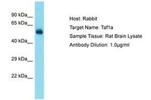 Image no. 1 for anti-TATA Box Binding Protein (TBP)-Associated Factor, RNA Polymerase I, A, 48kDa (TAF1A) (AA 51-100) antibody (ABIN6750276) (TAF1A anticorps  (AA 51-100))