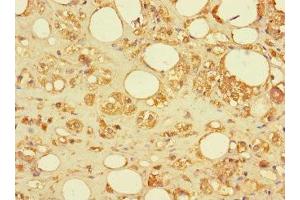 Immunohistochemistry of paraffin-embedded human adrenal gland tissue using ABIN7170737 at dilution of 1:100 (SAMD12 anticorps  (AA 1-201))