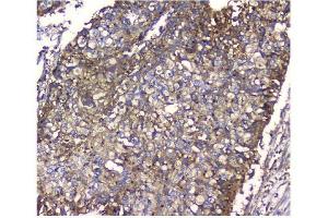 IHC analysis of NMI using anti-NMI antibody (ABIN3043451). (NMI anticorps  (AA 2-307))
