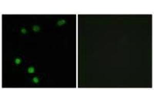 Immunofluorescence analysis of MCF-7 cells, using TP53INP2 antibody. (TP53INP2 anticorps)